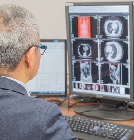 遠隔読影サポート事業